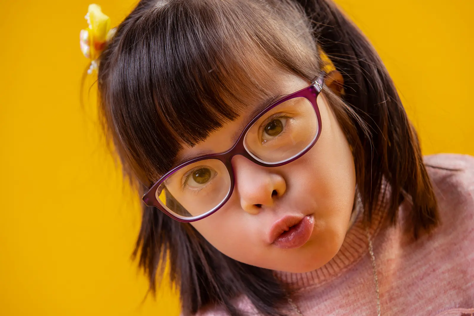 Smiling girl with special needs on yellow background